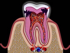 antique unhealthy Reassure Danties nervo uždegimas | Nepakeliamas danties skausmas | Pulpitas